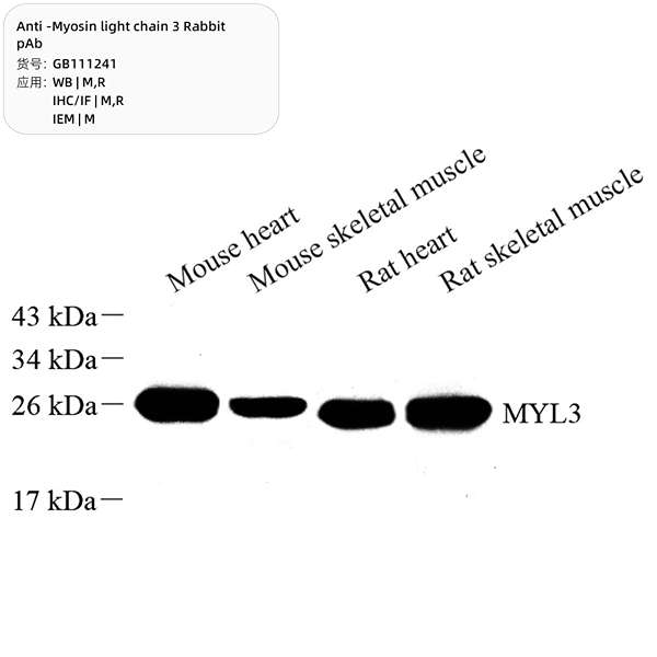 Антитела первичные, поликлональные, Myosin light chain 3, 100 мкл