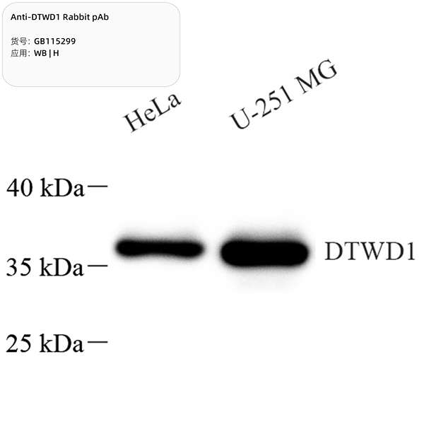 Антитела первичные, поликлональные, DTWD1, 100 мкл