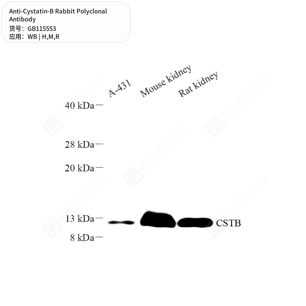 Антитела первичные, поликлональные кролика к Cystatin-B крысы, мыши, человека, 50 мкл