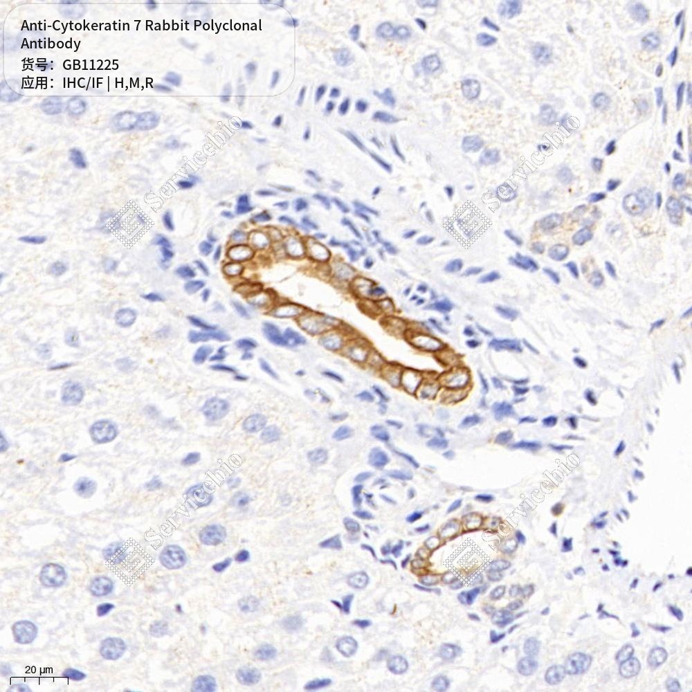 Антитела первичные, поликлональные кролика к Cytokeratin 7 крысы, мыши, человека, 100 мкл