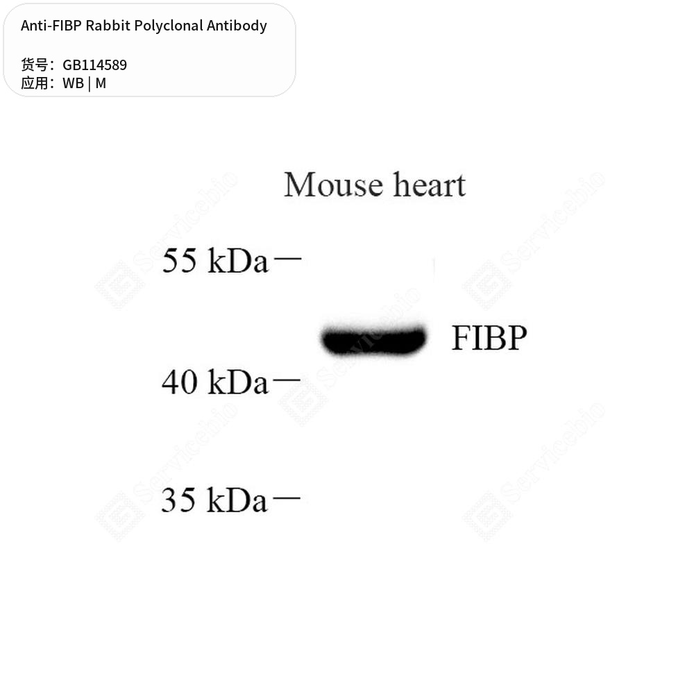 Антитела первичные, поликлональные кролика к FIBP мыши, 50 мкл