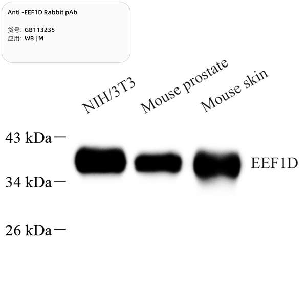 Антитела первичные, поликлональные, EEF1D, 100 мкл