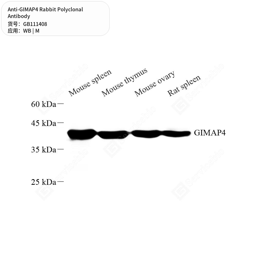 Антитела первичные, поликлональные кролика к GIMAP4 мыши, 100 мкл