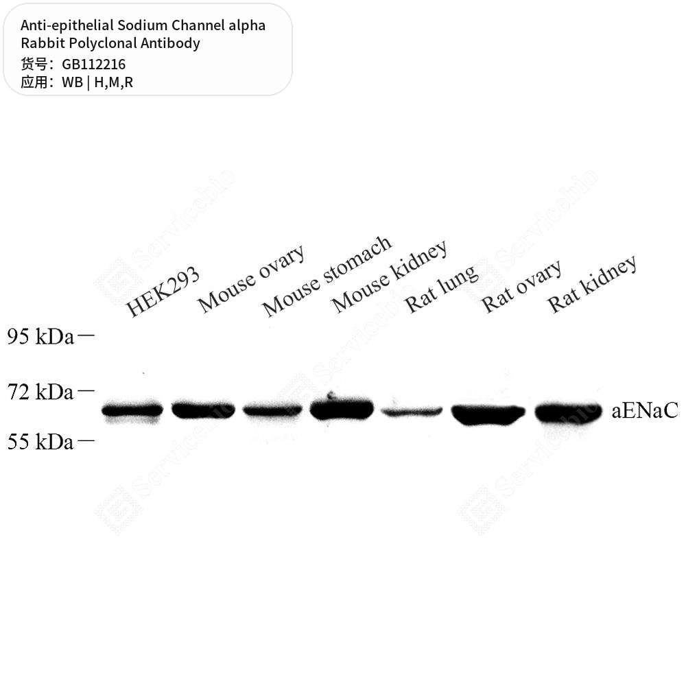 Антитела первичные, поликл. кролика к epithelial Sodium Channel alpha крысы, мыши, чел., 100 мкл