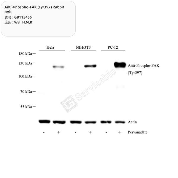 Антитела первичные, поликлональные, Phospho-FAK (Tyr397), 100 мкл