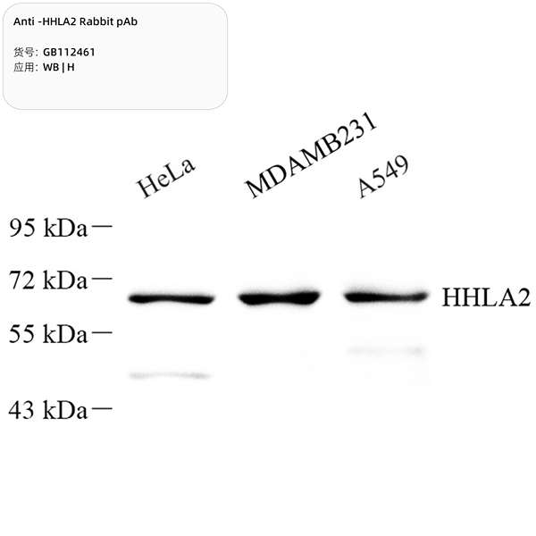 Антитела первичные, поликлональные, HHLA2, 100 мкл