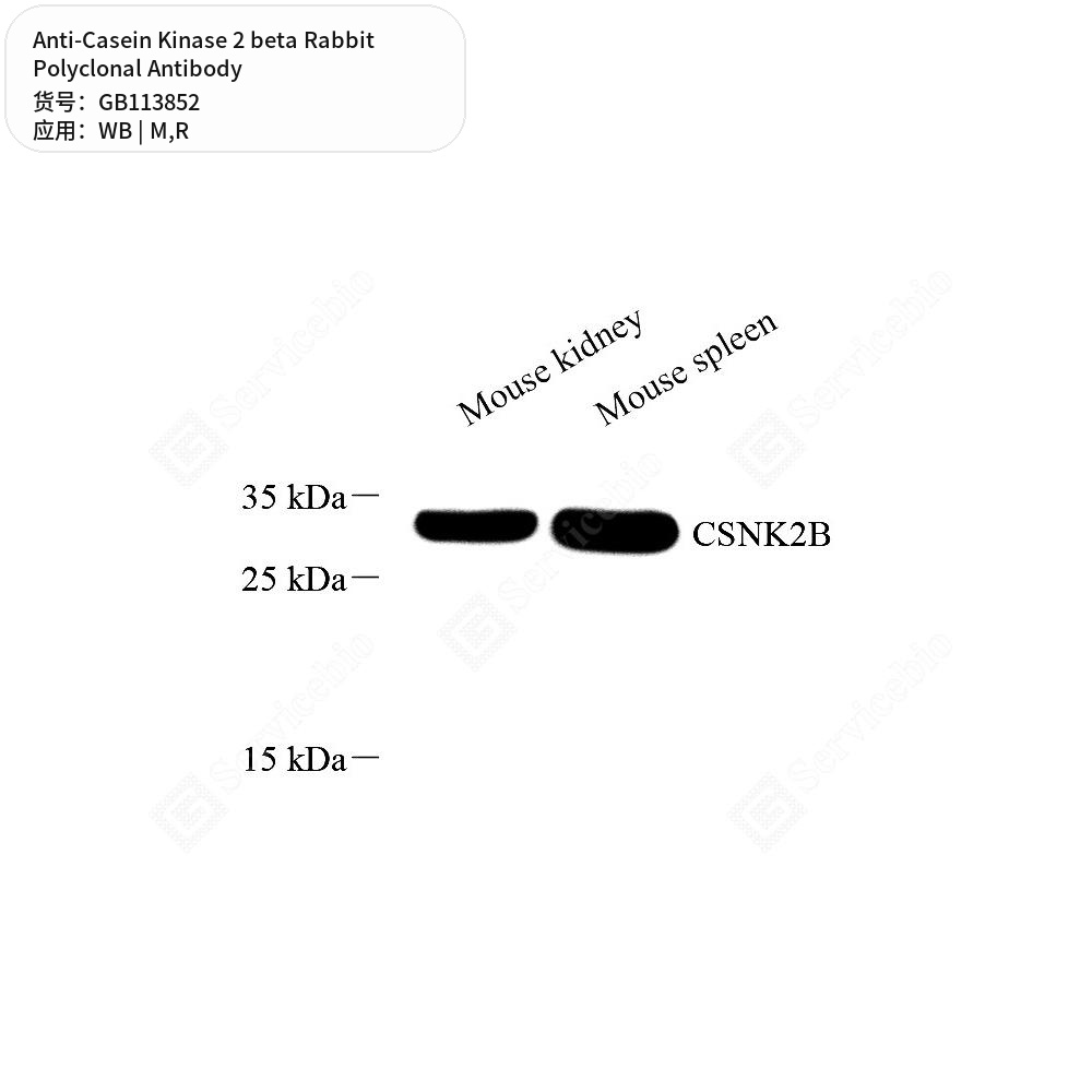Антитела первичные, поликлональные кролика к Casein Kinase 2 beta крысы, мыши, 100 мкл