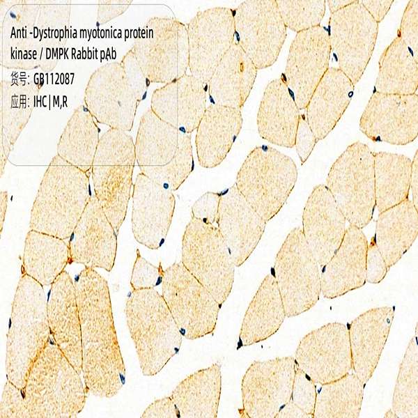 Антитела первичные, поликлональные, Dystrophia myotonica protein kinase/DMPK, 100 мкл
