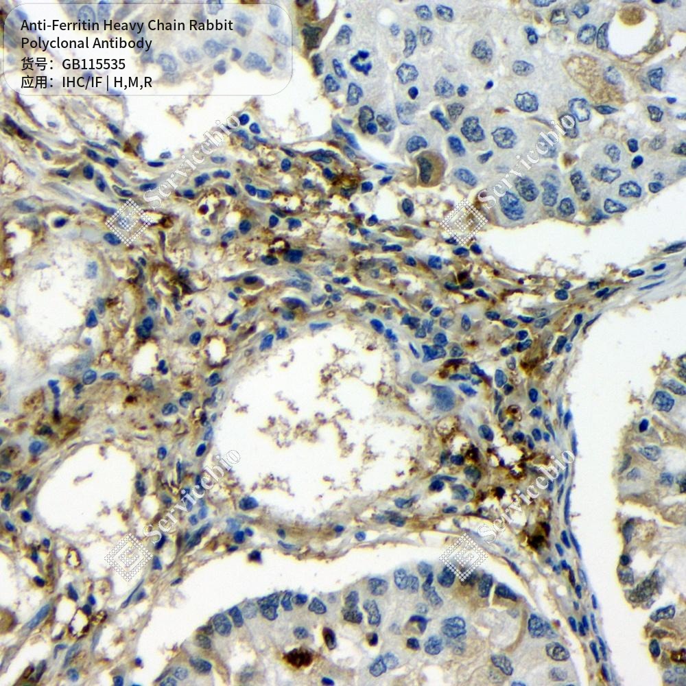 Антитела первичные, поликлональные кролика к Ferritin Heavy Chain крысы, мыши, человека, 50 мкл