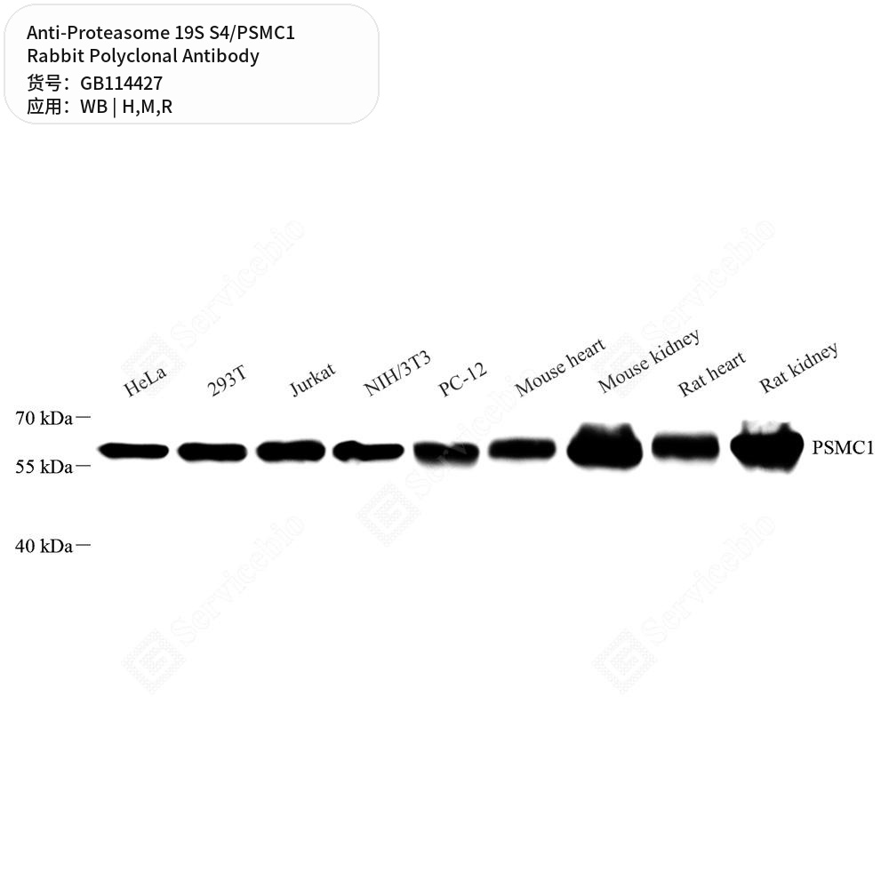 Антитела первичные, поликлональные кролика к Proteasome 19S S4/PSMC1 крысы, мыши, человека, 50 мкл
