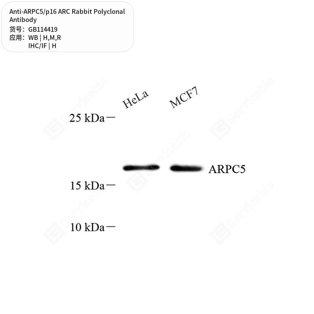 Антитела первичные, поликлональные кролика к ARPC5/p16 ARC крысы, мыши, человека, 100 мкл