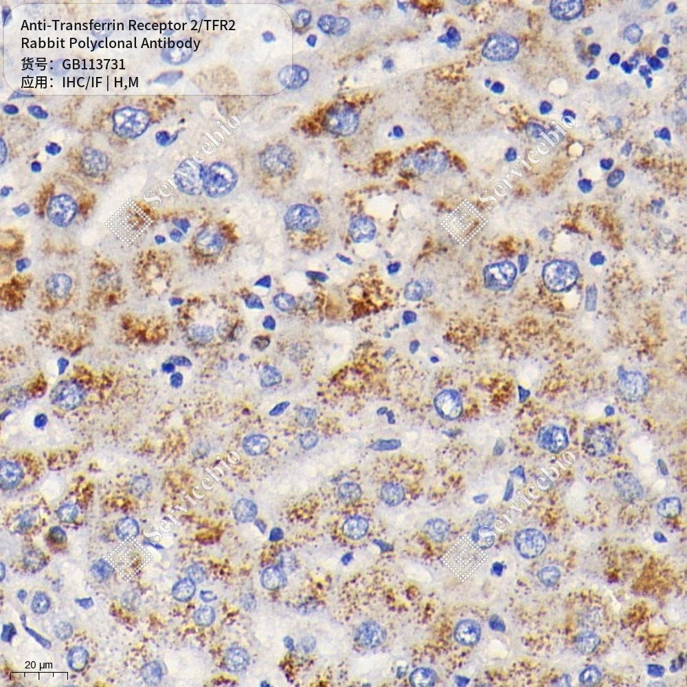 Антитела первичные, поликлональные кролика к Transferrin Receptor 2/TFR2 мыши, человека, 50 мкл