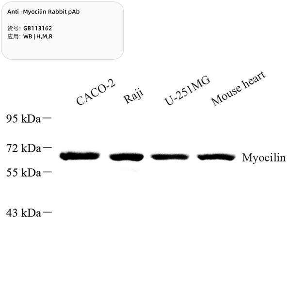 Антитела первичные, поликлональные, Myocilin, 100 мкл