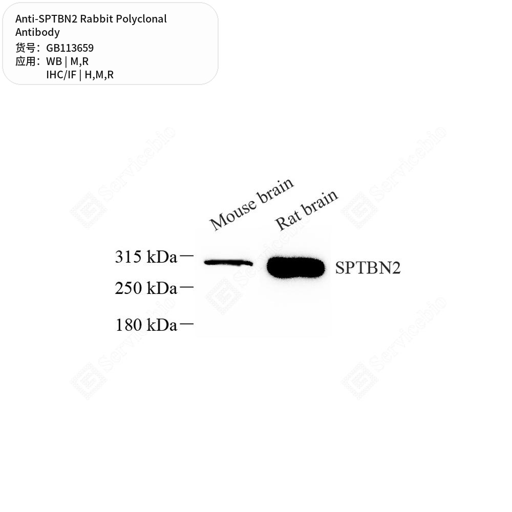Антитела первичные, поликлональные кролика к SPTBN2 крысы, мыши, человека, 100 мкл