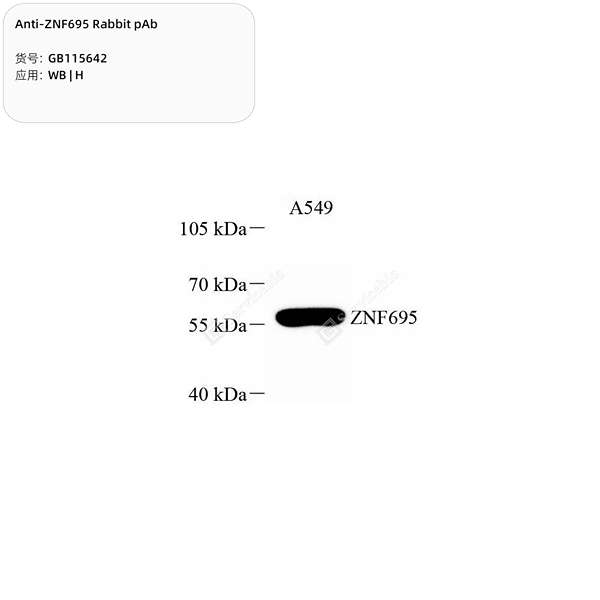 Антитела первичные, поликлональные, ZNF695, 100 мкл