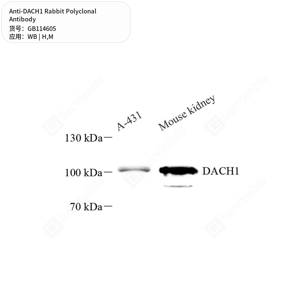 Антитела первичные, поликлональные кролика к DACH1 мыши, человека, 50 мкл