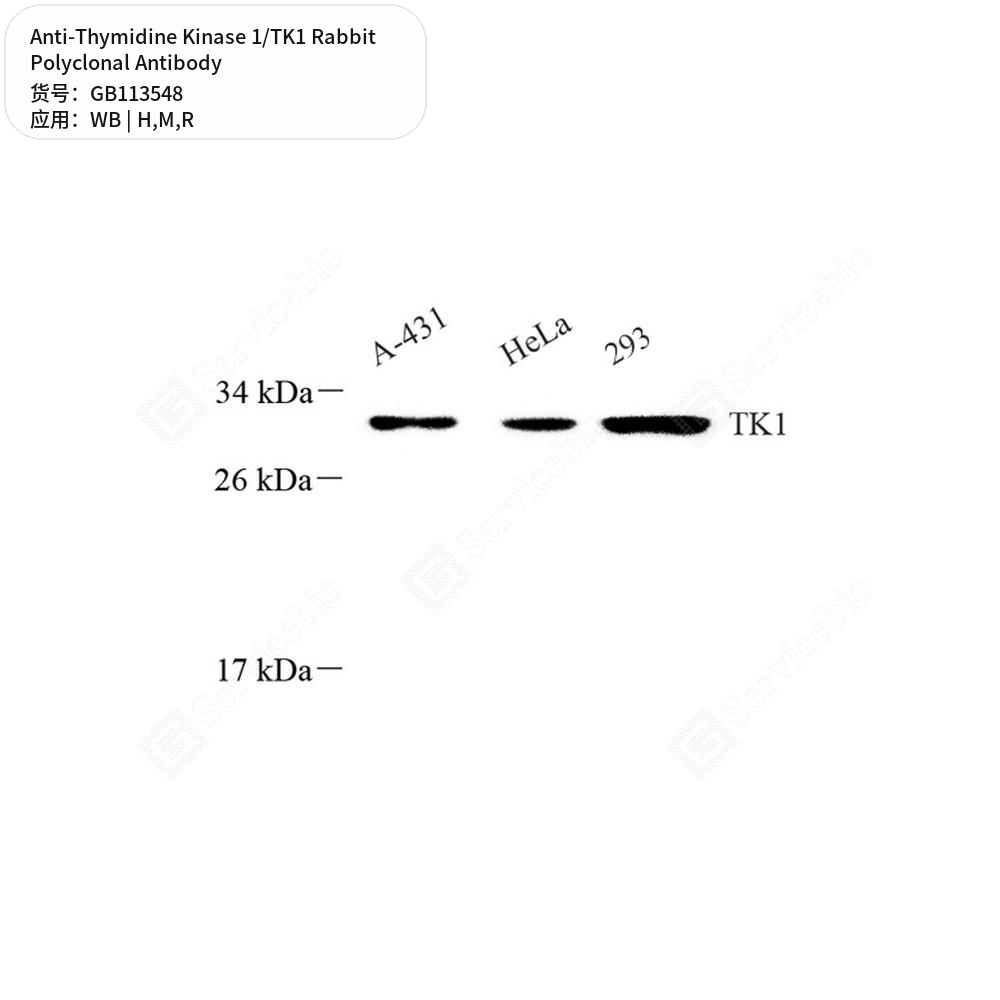 Антитела первичные, поликлональные кролика к Thymidine Kinase 1/TK1 крысы, мыши, человека, 100 мкл