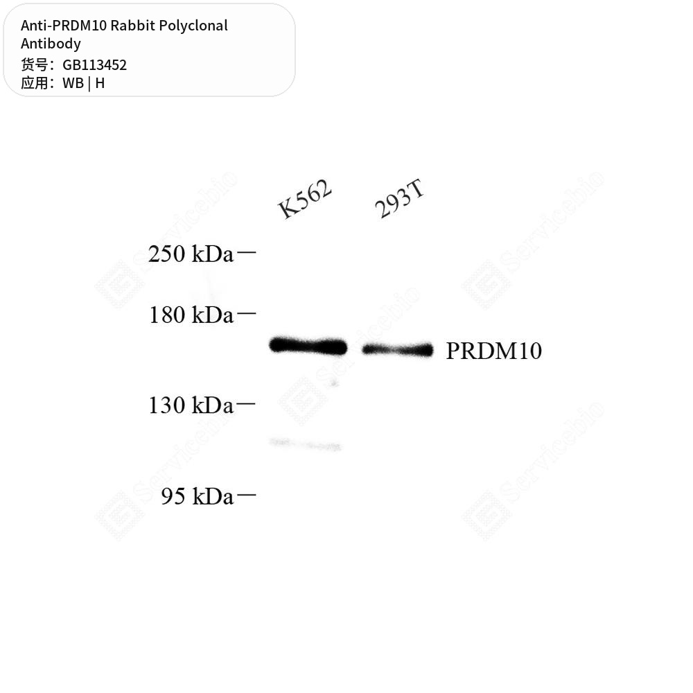 Антитела первичные, поликлональные кролика к PRDM10 человека, 100 мкл