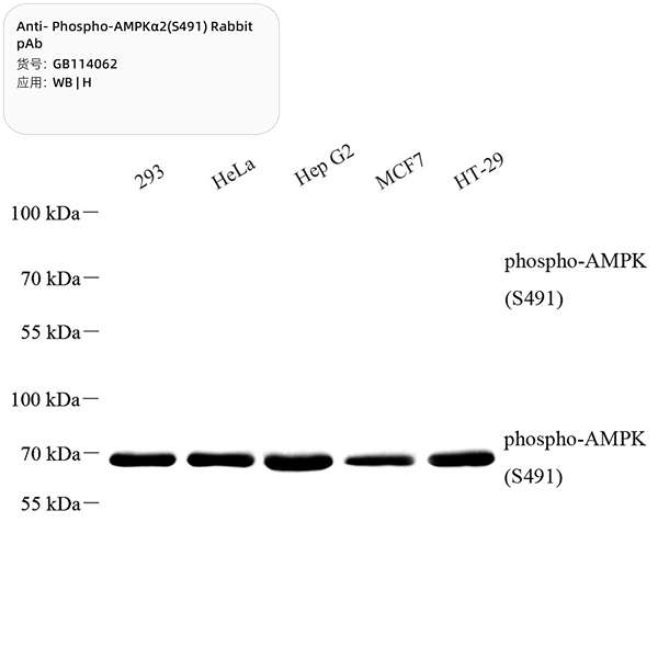 Антитела первичные, поликлональные, Phospho-AMPK alpha 2(S491), 100 мкл