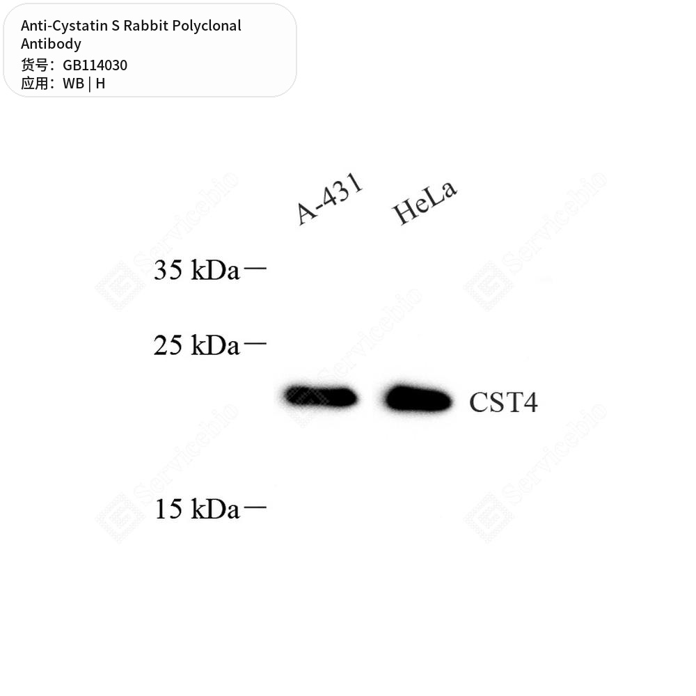 Антитела первичные, поликлональные кролика к Cystatin S человека, 50 мкл