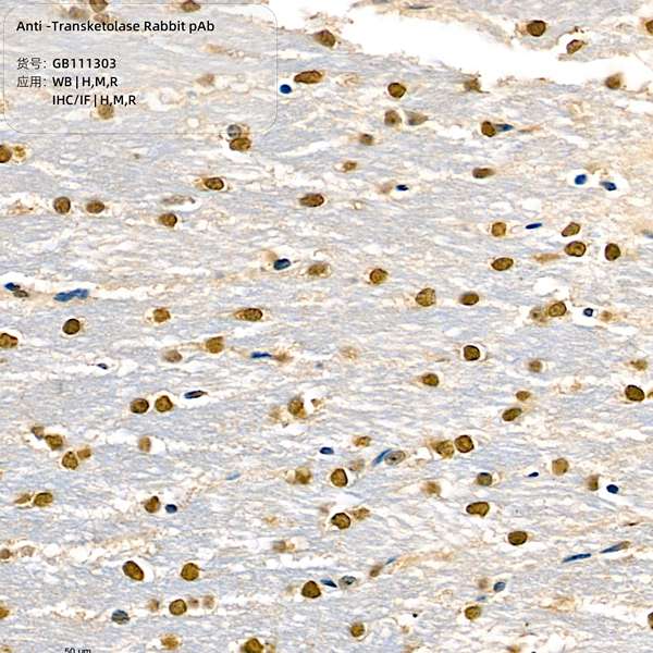 Антитела первичные, поликлональные, Transketolase, 100 мкл