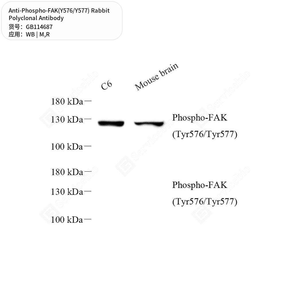 Антитела первичные, поликлональные кролика к Phospho-FAK(Y576/Y577) крысы, мыши, 50 мкл