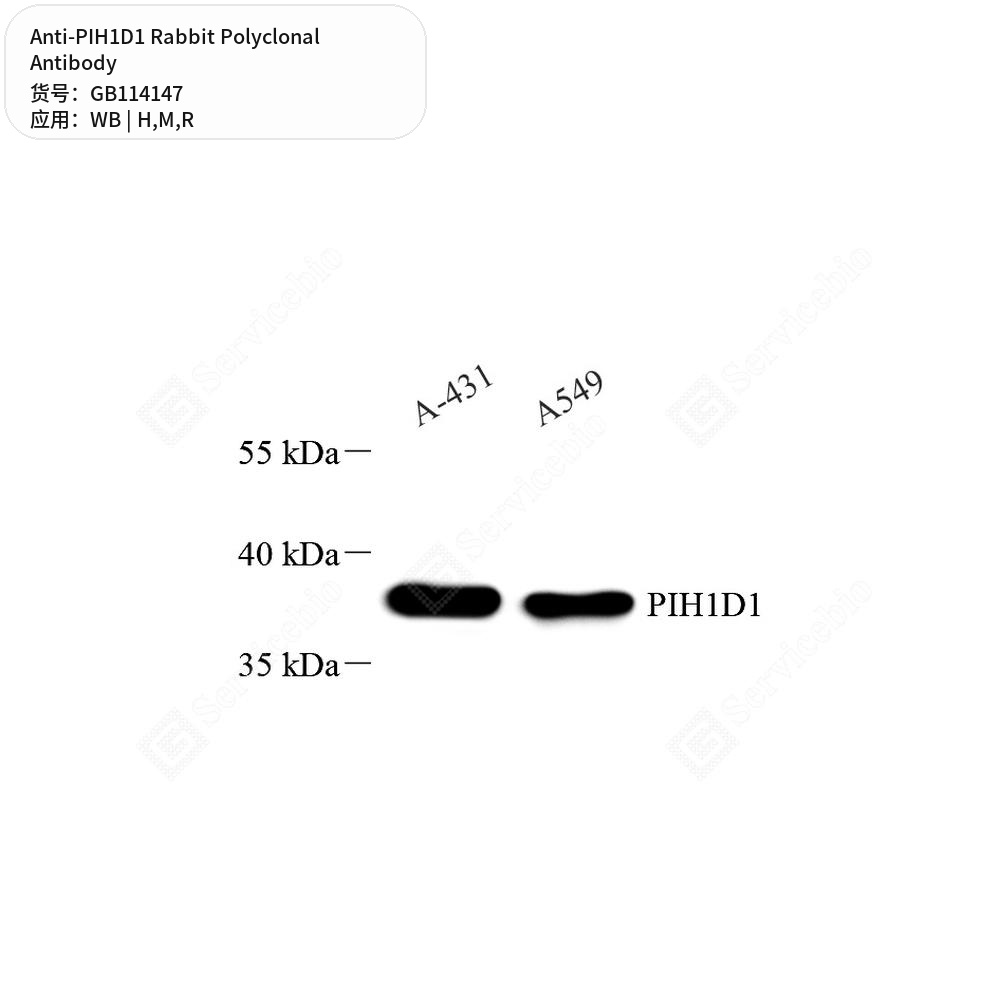 Антитела первичные, поликлональные кролика к PIH1D1 крысы, мыши, человека, 100 мкл
