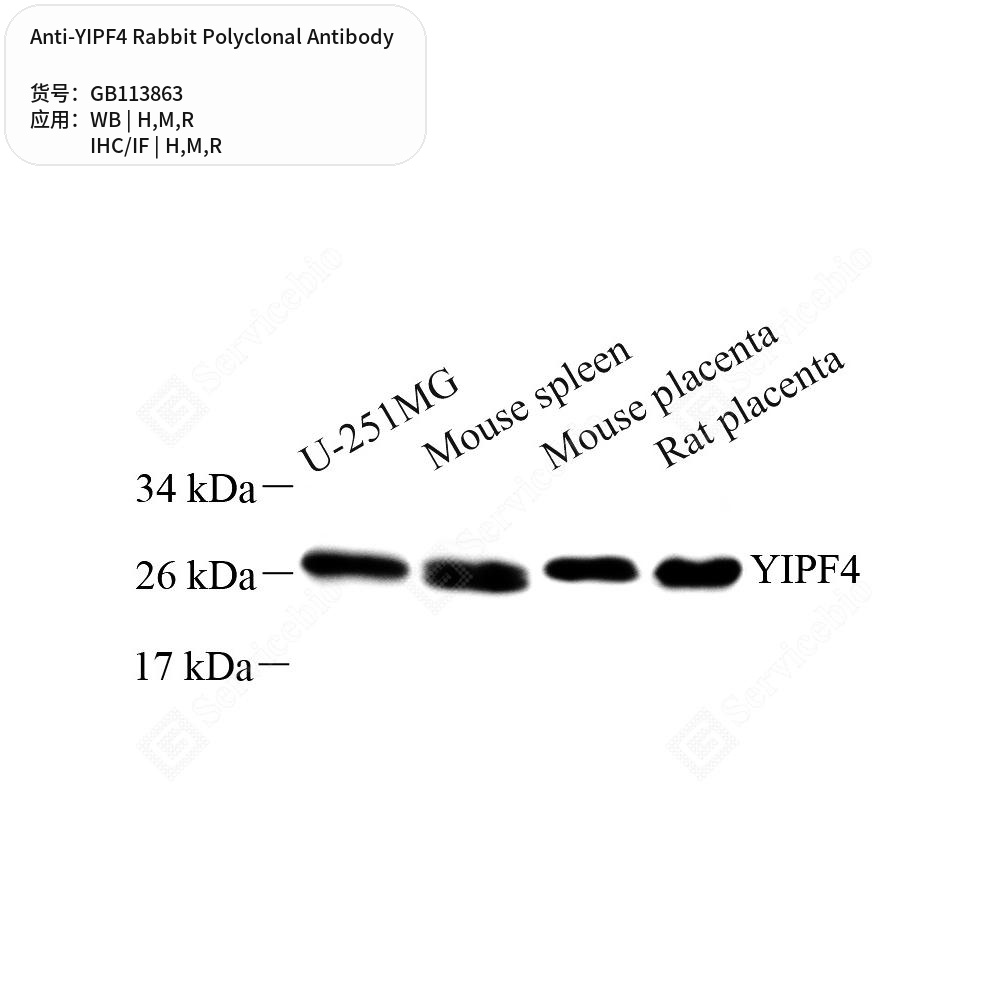 Антитела первичные, поликлональные кролика к YIPF4 крысы, мыши, человека, 50 мкл