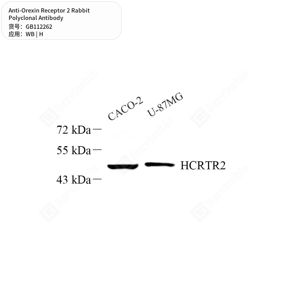 Антитела первичные, поликлональные кролика к Orexin Receptor 2 человека, 100 мкл
