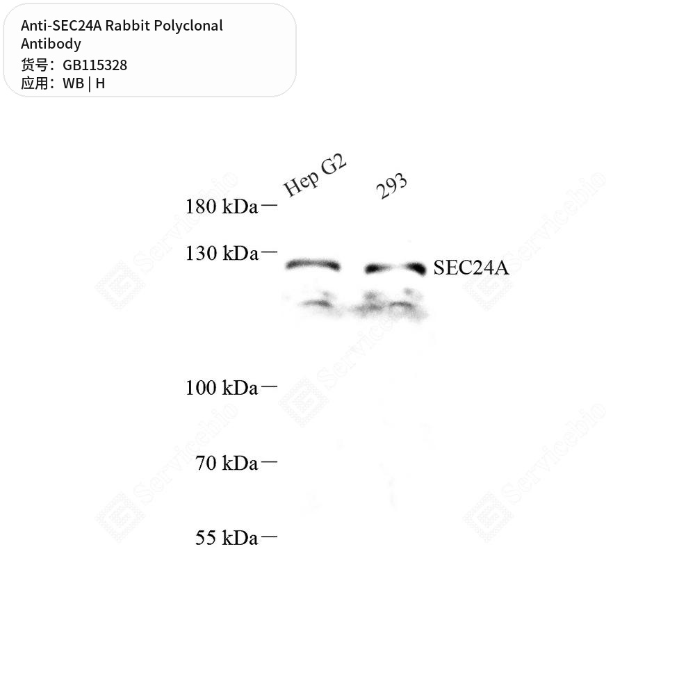 Антитела первичные, поликлональные кролика к SEC24A человека, 50 мкл