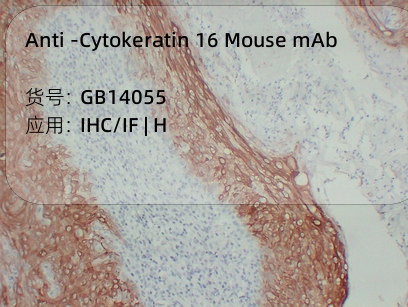 Антитела первичные, моноклональные мыши к Cytokeratin 16 человека, 50 мкл