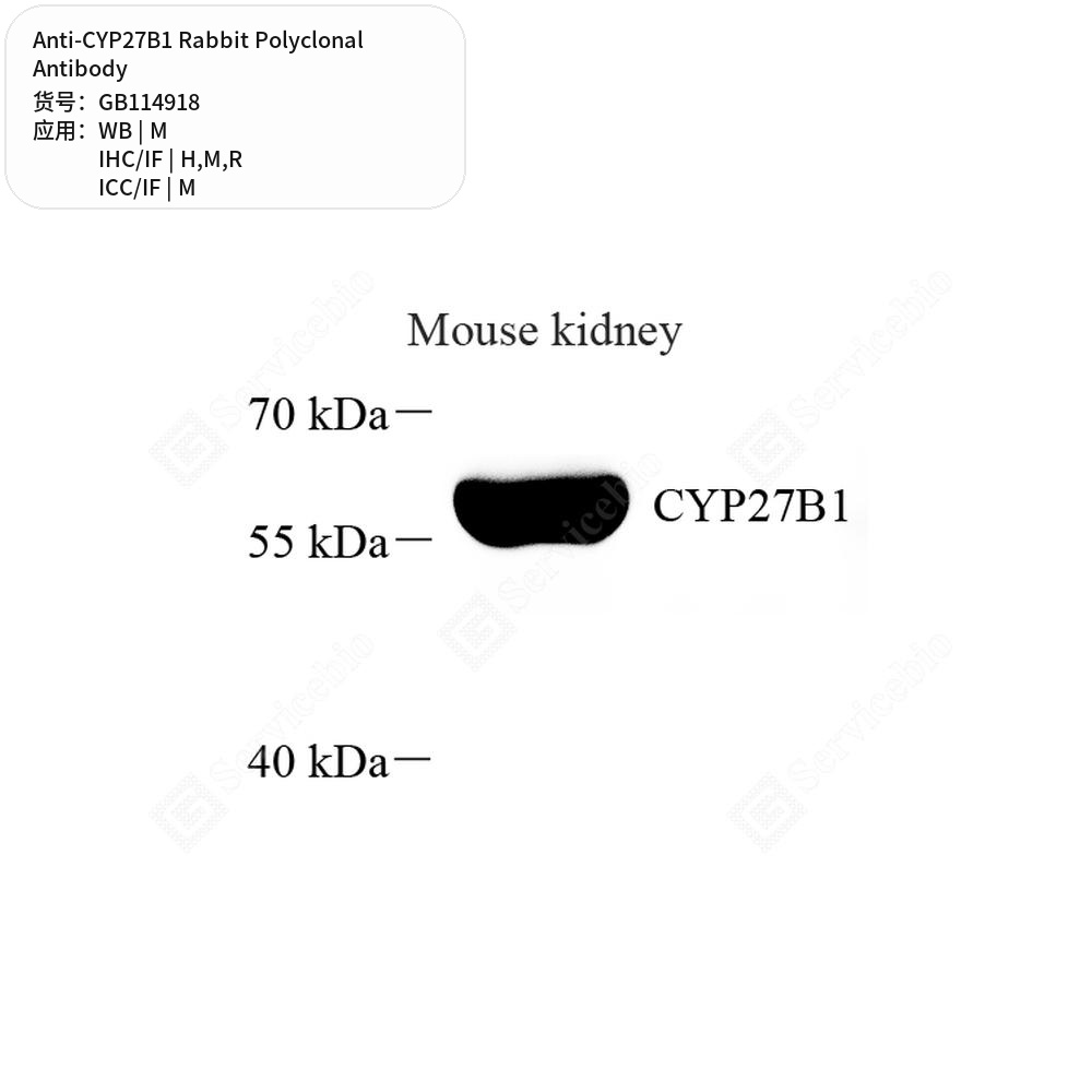 Антитела первичные, поликлональные кролика к CYP27B1 крысы, мыши, человека, 50 мкл