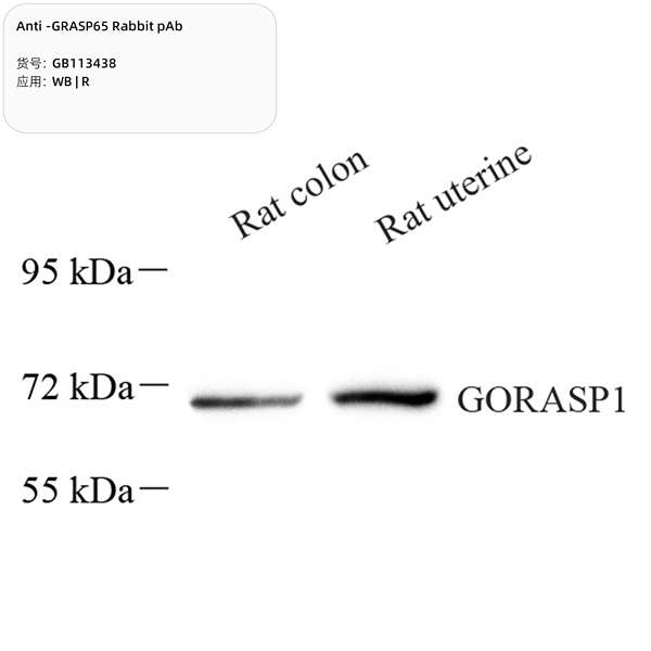 Антитела первичные, поликлональные, GRASP65, 100 мкл