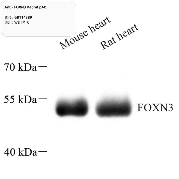 Антитела первичные, поликлональные, FOXN3, 100 мкл
