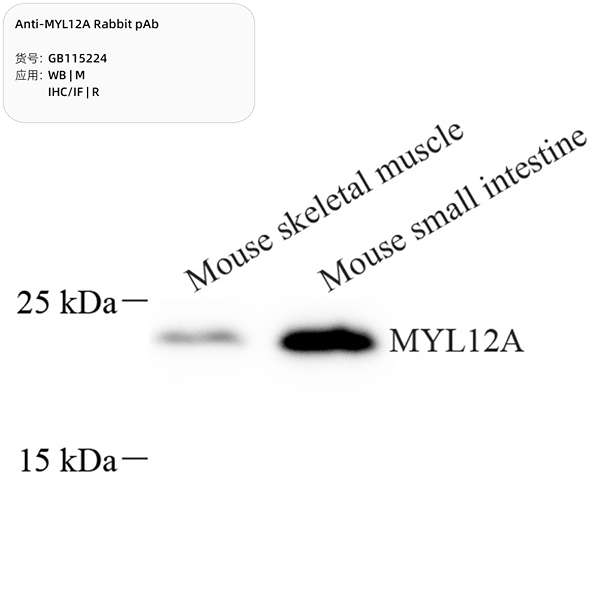 Антитела первичные, поликлональные, MYL12A, 100 мкл