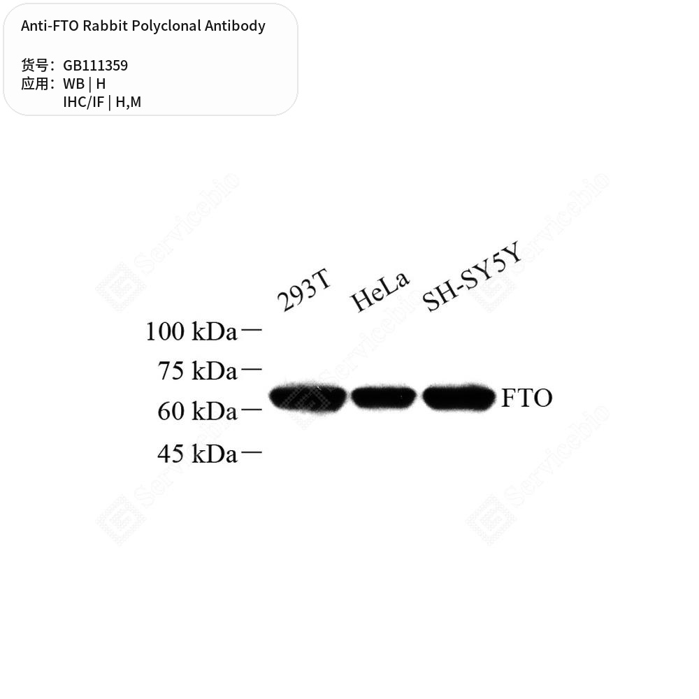 Антитела первичные, поликлональные кролика к FTO мыши, человека, 100 мкл