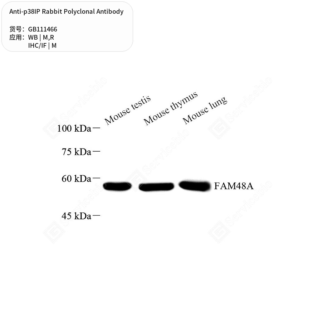 Антитела первичные, поликлональные кролика к p38IP крысы, мыши, 100 мкл
