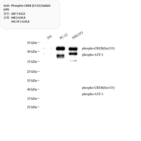 Антитела первичные, поликлональные, Phospho-CREB (S133), 100 мкл