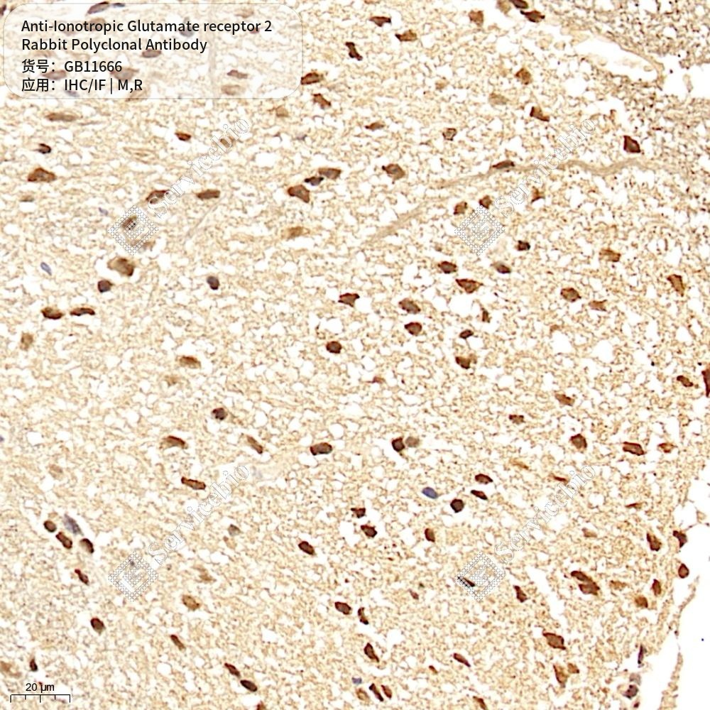 Антитела первичные, поликлональные кролика к Ionotropic Glutamate receptor 2 крысы, мыши, 50 мкл