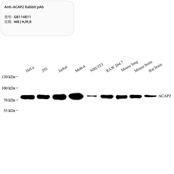 Антитела первичные, поликлональные, ACAP2, 100 мкл