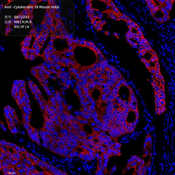 Антитела первичные, моноклональные, Cytokeratin 18, 100 мкл