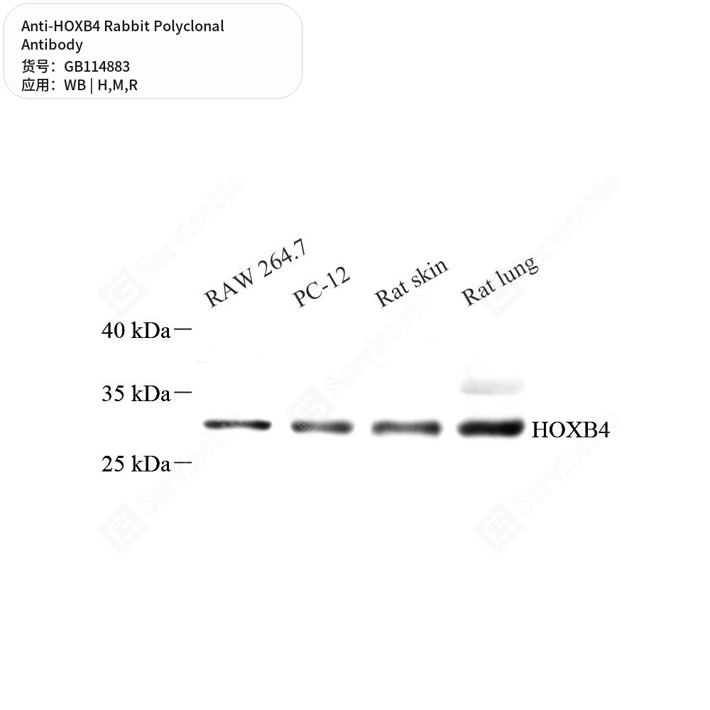 Антитела первичные, поликлональные кролика к HOXB4 крысы, мыши, человека, 50 мкл