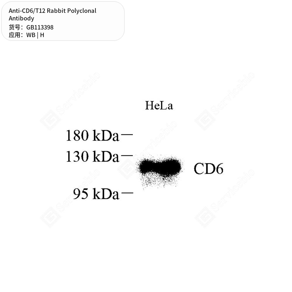 Антитела первичные, поликлональные кролика к CD6/T12 человека, 100 мкл