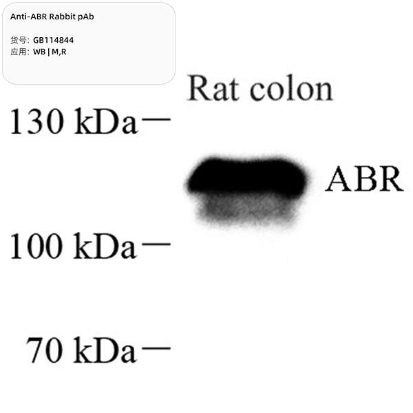 Антитела первичные, поликлональные, ABR, 100 мкл