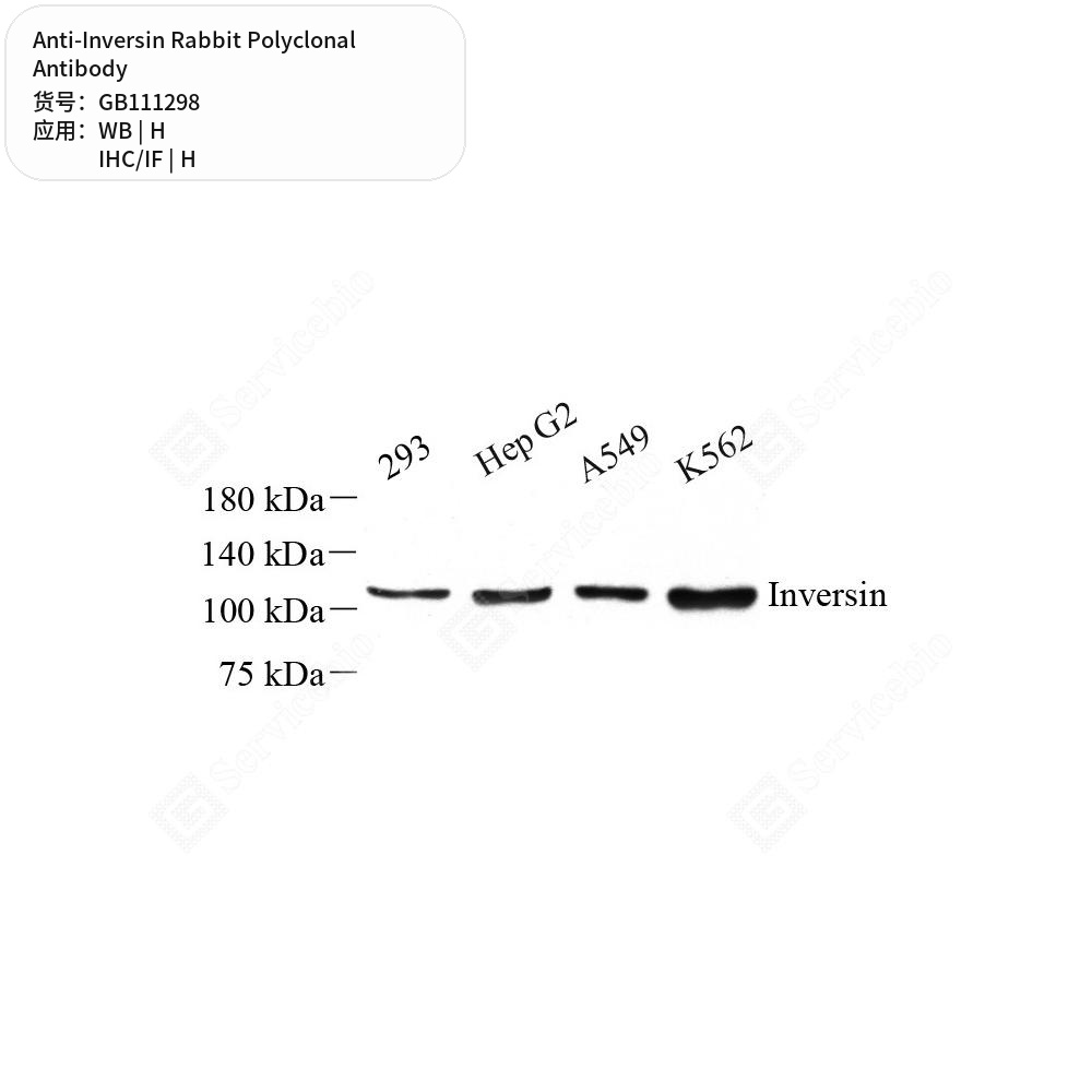 Антитела первичные, поликлональные кролика к Inversin человека, 50 мкл