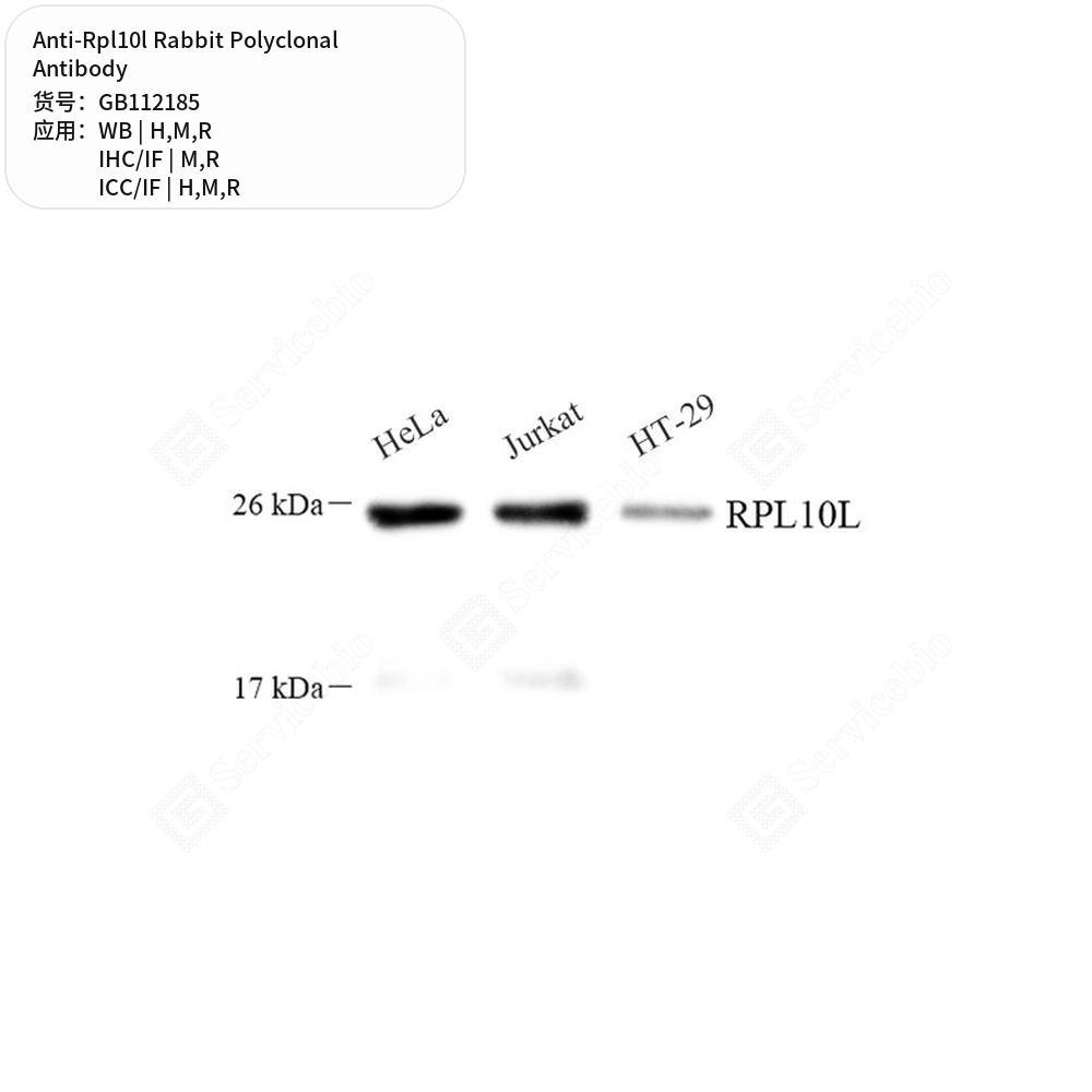 Антитела первичные, поликлональные кролика к Rpl10l крысы, мыши, человека, 100 мкл