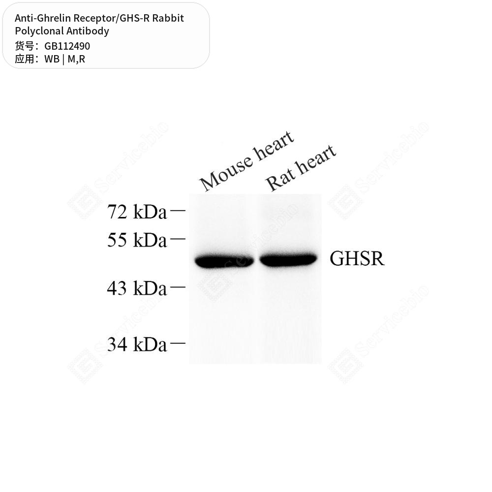 Антитела первичные, поликлональные кролика к Ghrelin Receptor/GHS-R крысы, мыши, 100 мкл