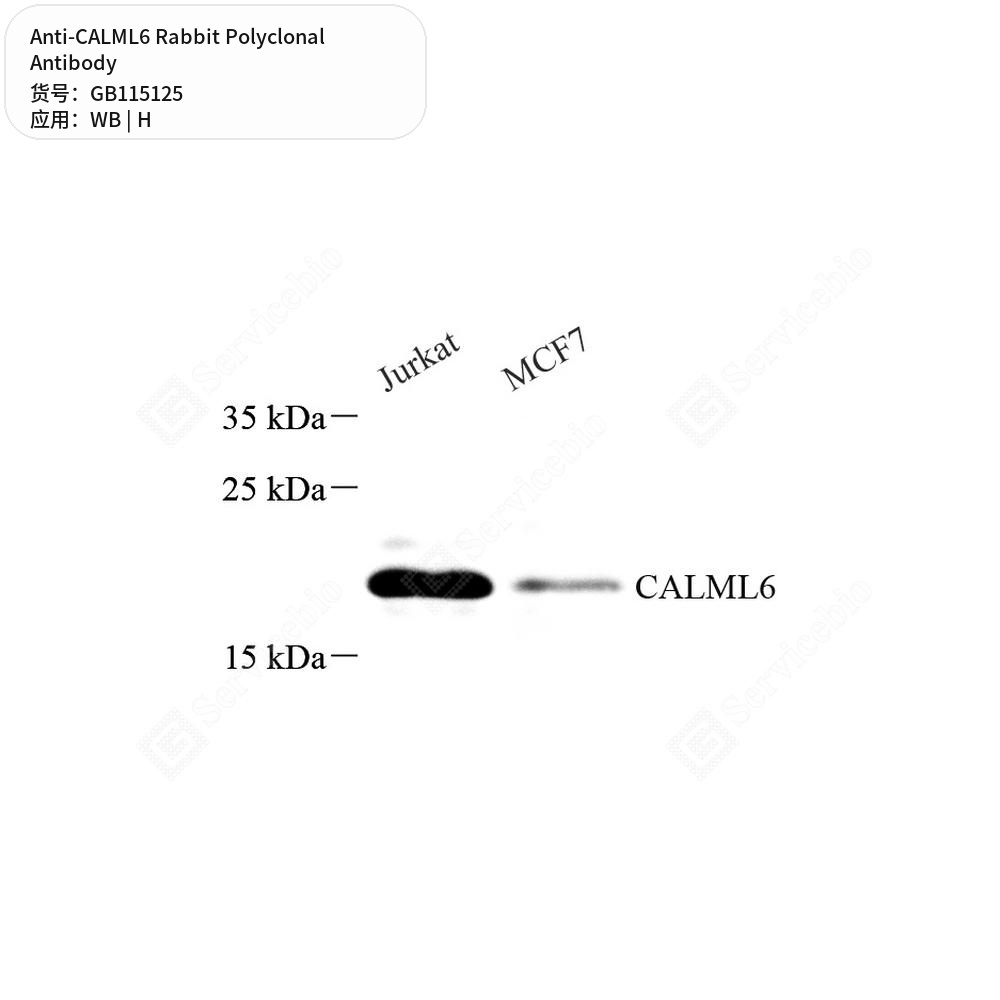 Антитела первичные, поликлональные кролика к CALML6 человека, 100 мкл
