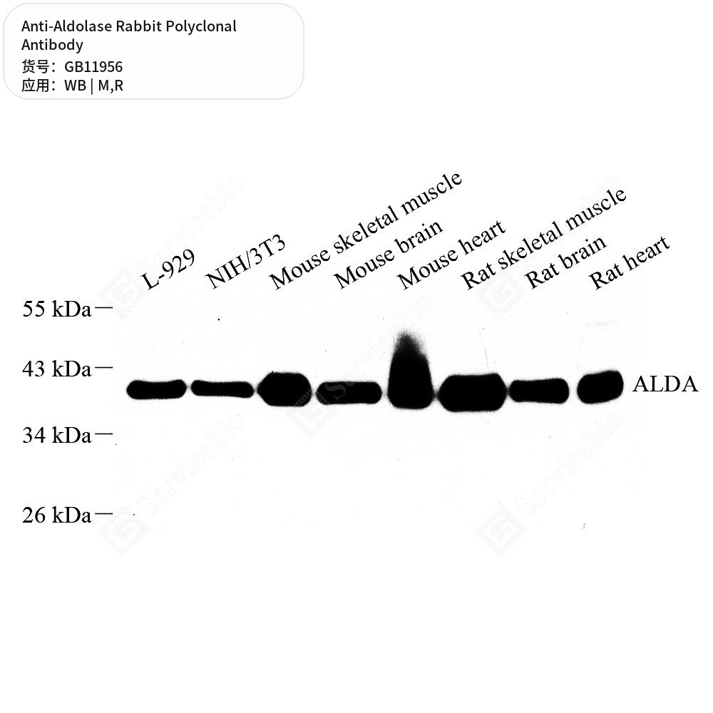 Антитела первичные, поликлональные кролика к Aldolase крысы, мыши, 50 мкл
