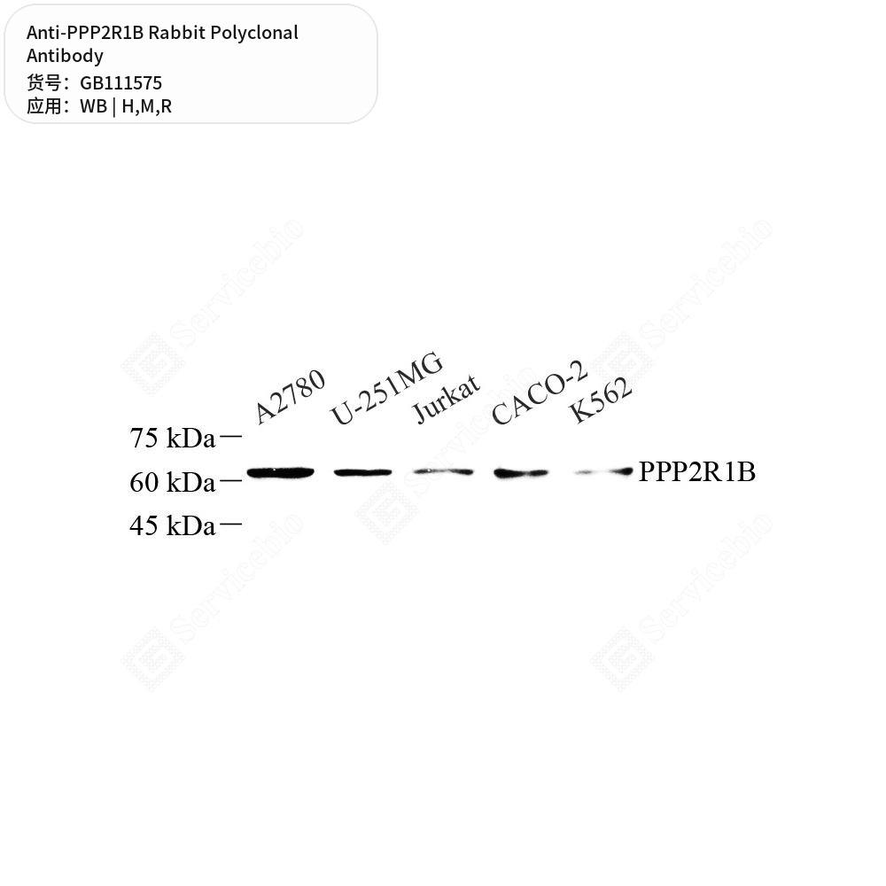 Антитела первичные, поликлональные кролика к PPP2R1B крысы, мыши, человека, 100 мкл